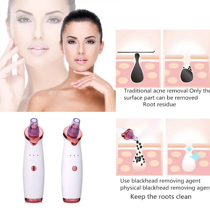 Blackhead Remover Instrument Black Dot Remover Acne Vacuum Suction Face Clean Black Head Pore Cleaning Beauty Skin Care Tool samsegir